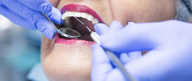 Best Walk-In Emergency Dentist in Rosebud, SD